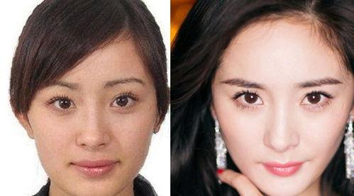 鼻子整形的明星,揭秘美丽蜕变之路